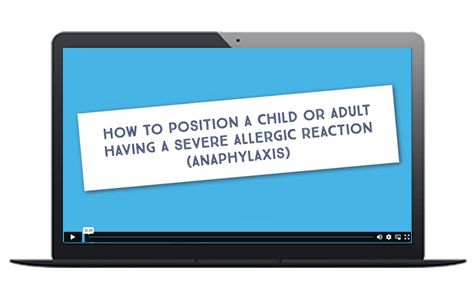 Anaphylaxis positioning animation